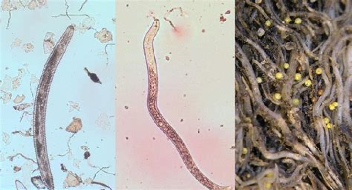 Are nematodes harmful